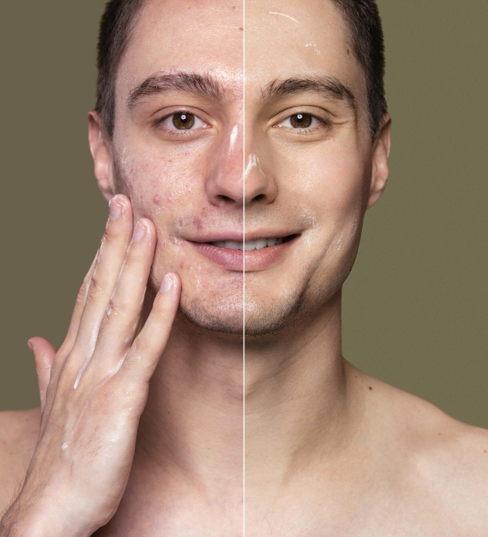 before-after-portrait-young-man-retouched