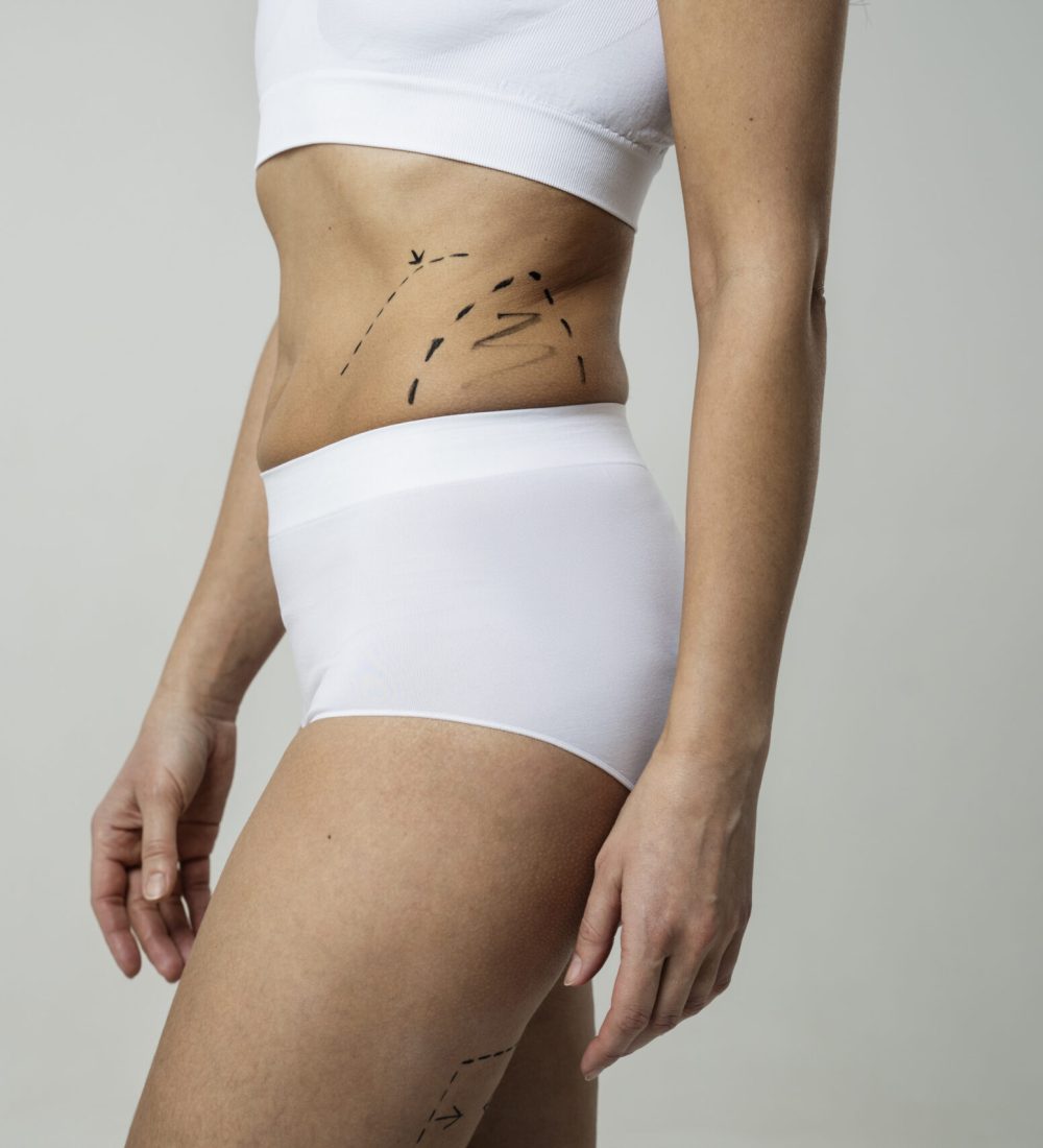 side-view-woman-with-marker-traces-skin