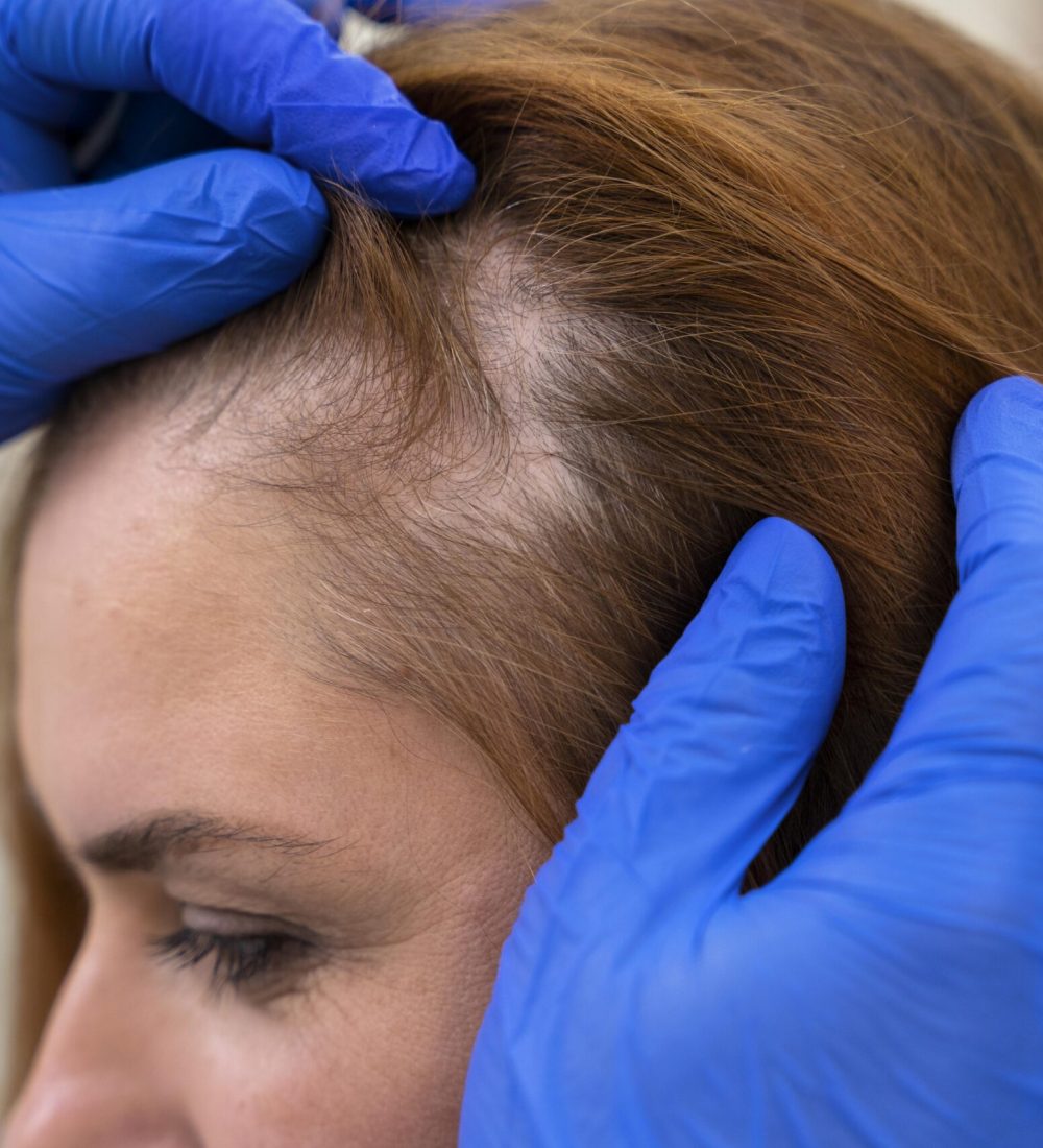 woman-getting-hair-loss-treatment-clinic